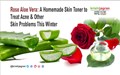 Rose Aloe Vera: A Homemade Skin Toner to Treat Acne & Other Skin Problems This Winter