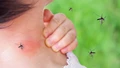 How to Ensure Mosquito Free Surroundings? Tips & Hacks to Protect Yourself from Mosquito Bites