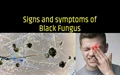 Black Fungus or Mucormycosis: How to identify signs and symptoms in COVID Cases?