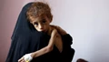 UN Food Agency: 13 Million Yemenis Likely To Face Starvation