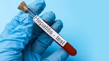 WHO Says Hepatitis Kills 3,500 People Every Day
