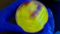 New Strain of Lactic Acid Bacterium Could Be Promising Probiotic for Food and Pharmaceutical Industry